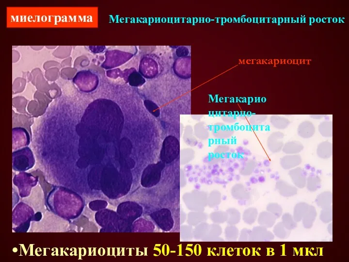 Мегакариоцитарно-тромбоцитарный росток мегакариоцит Мегакариоциты 50-150 клеток в 1 мкл миелограмма Мегакариоцитарно-тромбоцитарный росток