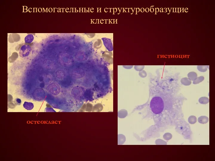 Вспомогательные и структурообразущие клетки остеокласт гистиоцит