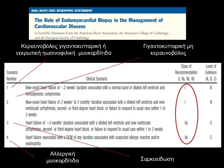 Κεραυνοβόλος γιγαντοκυτταρική ή νεκρωτική ηωσινοφιλική μυοκαρδίτιδα Γιγαντοκυτταρική μη κεραυνοβόλος Σαρκοείδωση Αλλεργική μυοκαρδίτιδα