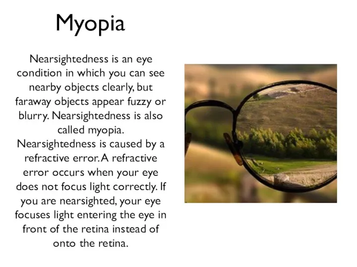 Myopia Nearsightedness is an eye condition in which you can see nearby objects