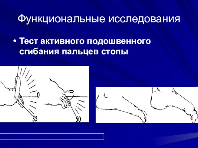 Функциональные исследования Тест активного подошвенного сгибания пальцев стопы
