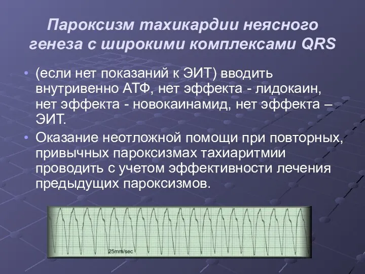 Пароксизм тахикардии неясного генеза с широкими комплексами QRS (если нет