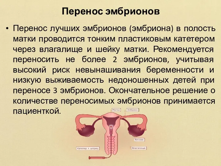Перенос эмбрионов Перенос лучших эмбрионов (эмбриона) в полость матки проводится