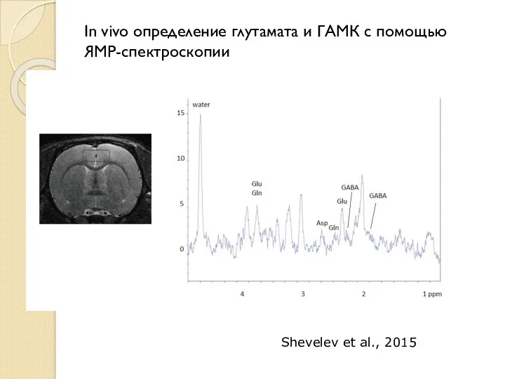 In vivo определение глутамата и ГАМК с помощью ЯМР-спектроскопии Shevelev et al., 2015