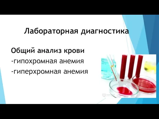 Лабораторная диагностика Общий анализ крови -гипохромная анемия -гиперхромная анемия