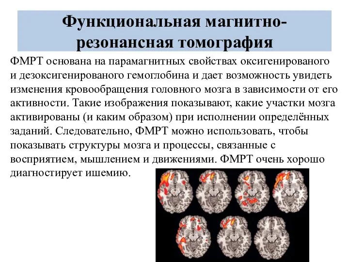 Функциональная магнитно-резонансная томография ФМРТ основана на парамагнитных свойствах оксигенированого и