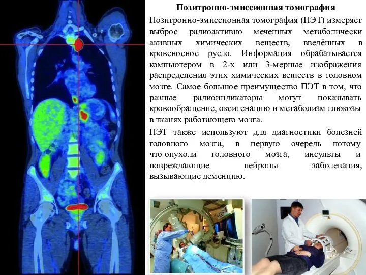 Позитронно-эмиссионная томография Позитронно-эмиссионная томография (ПЭТ) измеряет выброс радиоактивно меченных метаболически