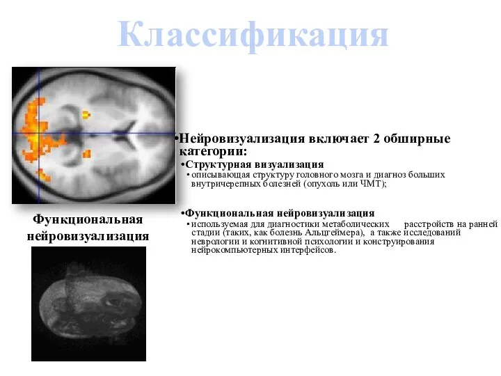 Классификация Функциональная нейровизуализация Нейровизуализация включает 2 обширные категории: Структурная визуализация