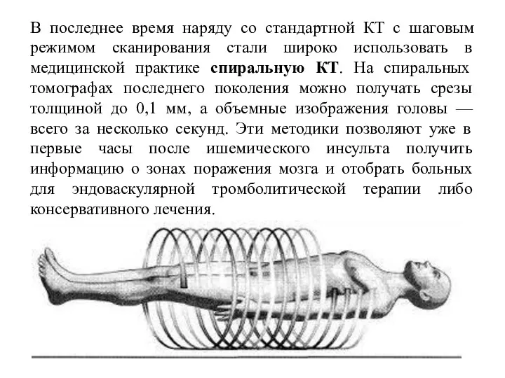 В последнее время наряду со стандартной КТ с шаговым режимом