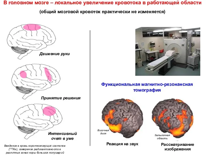 Введение в кровь короткоживущих изотопов (133Xe), измерение радиоактивности в различных зонах коры больших