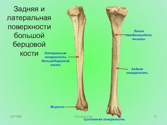 Суставная поверхность Линия камбаловидной мышцы Задняя поверхность Латеральная поверхность большеберцовой кости Вырезка Задняя