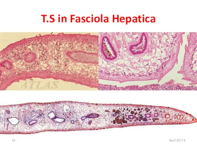 T.S in Fasciola Hepatica 6 April 2017