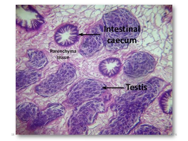 Intestinal caecum Testis Parenchyma tissue 6 April 2017