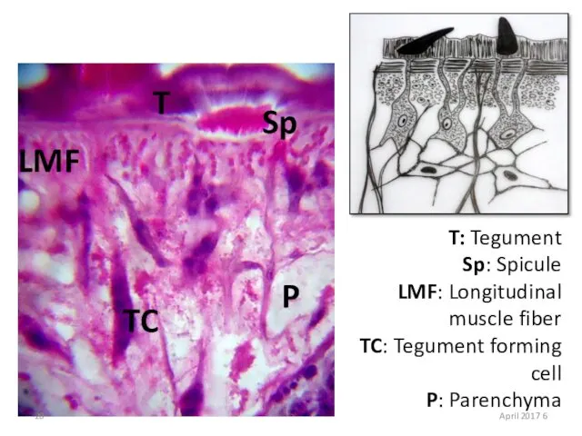 T Sp TC LMF P T: Tegument Sp: Spicule LMF: