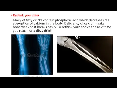 Rethink your drink Many of fizzy drinks contain phosphoric acid