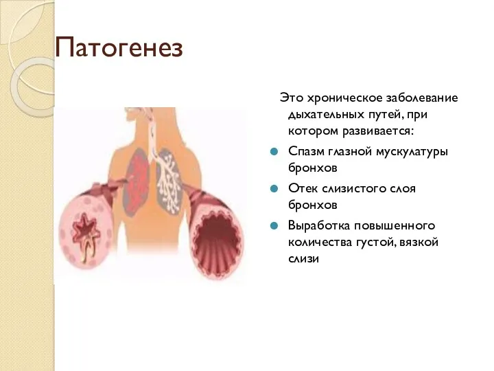 Патогенез Это хроническое заболевание дыхательных путей, при котором развивается: Спазм