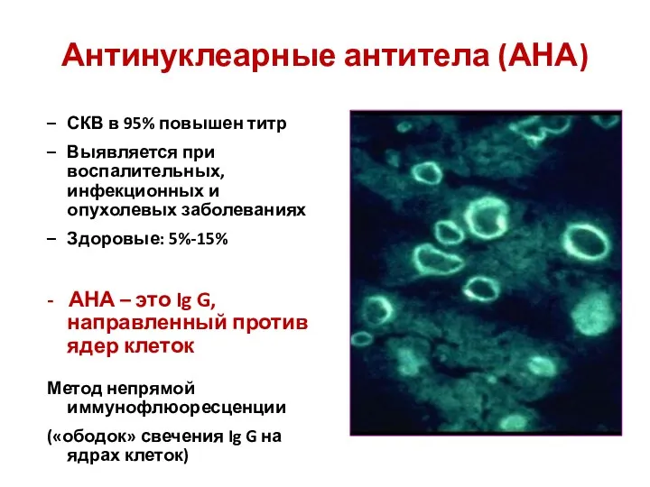 Антинуклеарные антитела (АНА) СКВ в 95% повышен титр Выявляется при воспалительных, инфекционных и