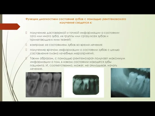 Функции диагностики состояния зубов с помощью рентгеновского излучения сводятся к: получению достоверной и