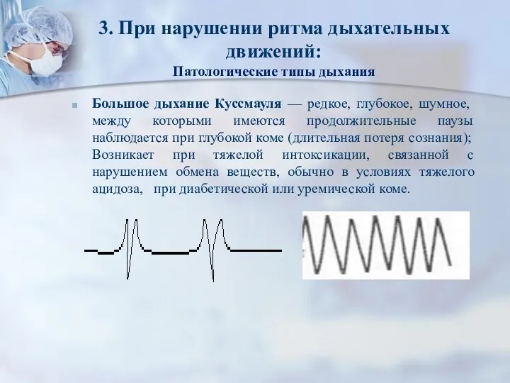 3. При нарушении ритма дыхательных движений: Патологические типы дыхания Большое