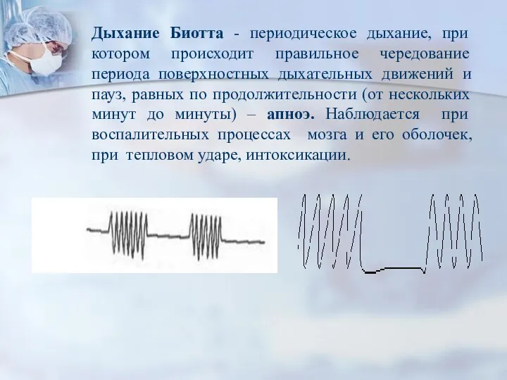 Дыхание Биотта - периодическое дыхание, при котором происходит правильное чередование