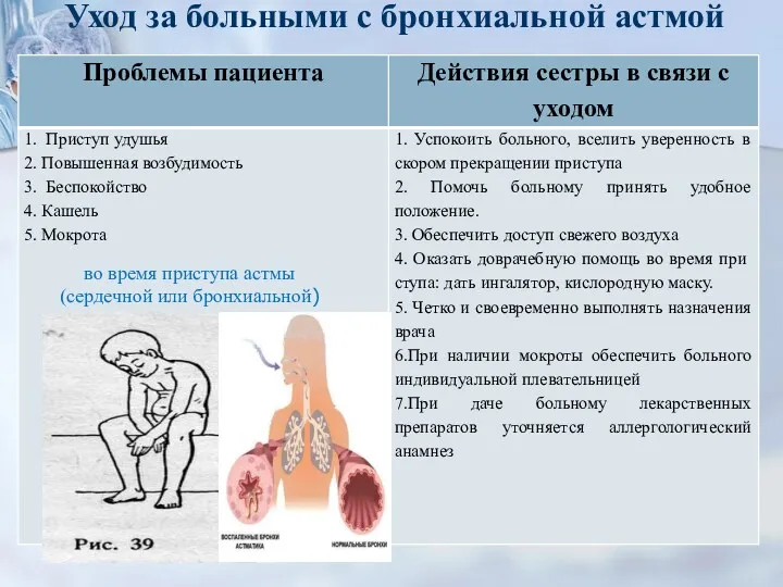 Уход за больными с бронхиальной астмой во время приступа астмы (сердечной или бронхиальной)