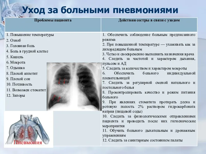 Уход за больными пневмониями