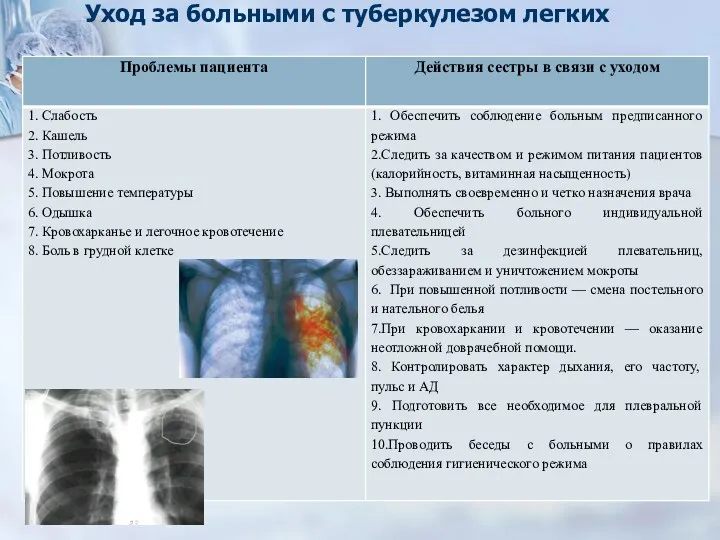 Уход за больными с туберкулезом легких