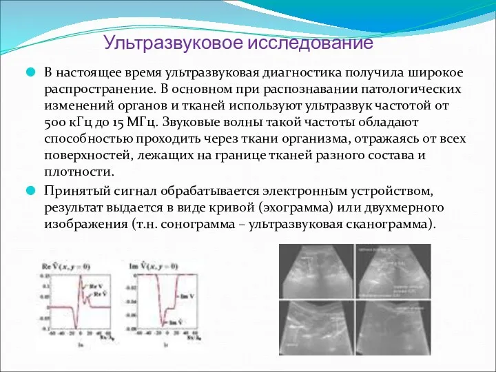 Ультразвуковое исследование В настоящее время ультразвуковая диагностика получила широкое распространение. В основном при