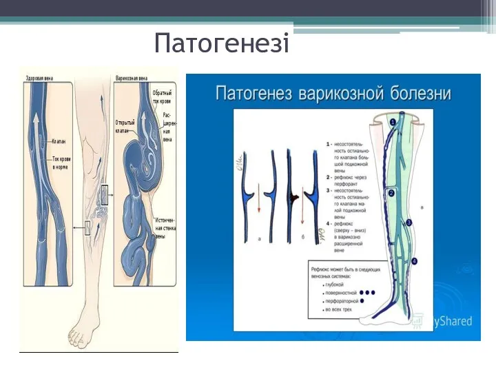 Патогенезі