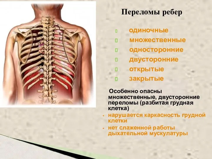 Переломы ребер одиночные множественные односторонние двусторонние открытые закрытые Особенно опасны