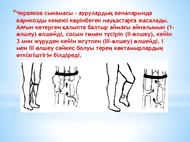 Червяков сынамасы – аурулардың веналарында варикозды кеңеюі көрінбеген науқастарға жасалады.