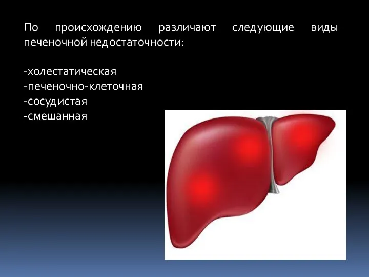 По происхождению различают следующие виды печеночной недостаточности: -холестатическая -печеночно-клеточная -сосудистая -смешанная