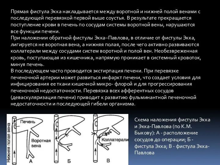 Прямая фистула Экка накладывается между воротной и нижней полой венами