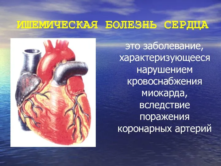 ИШЕМИЧЕСКАЯ БОЛЕЗНЬ СЕРДЦА это заболевание, характеризующееся нарушением кровоснабжения миокарда, вследствие поражения коронарных артерий