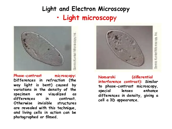 Light and Electron Microscopy Light microscopy Phase-contrast microscopy: Differences in
