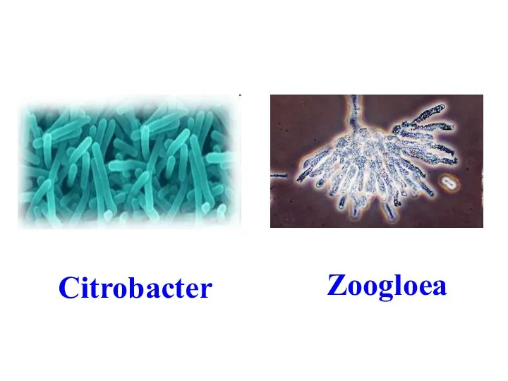 Citrobacter Zoogloea