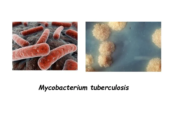 Mycobacterium tuberculosis