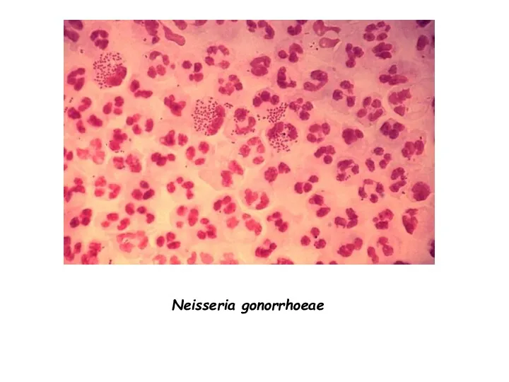 Neisseria gonorrhoeae