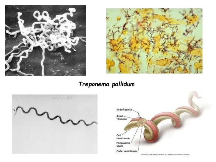 Treponema pallidum