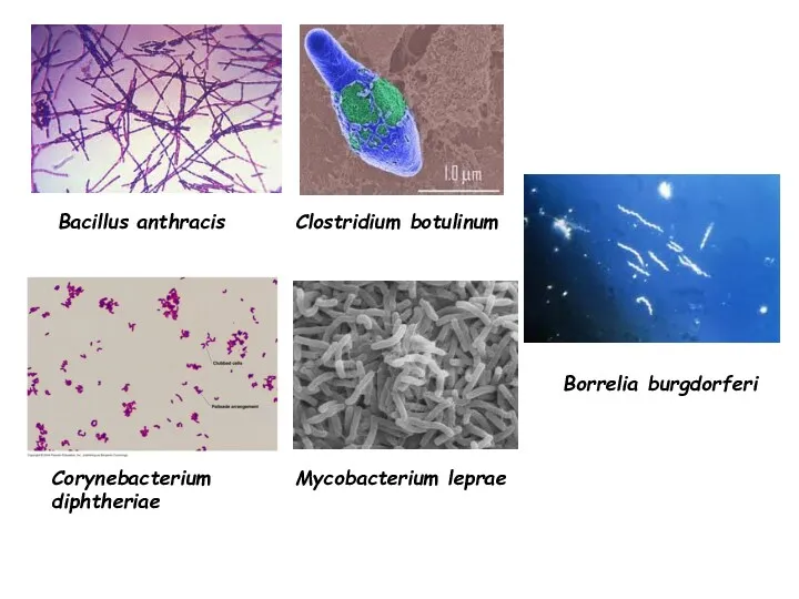 Bacillus anthracis Clostridium botulinum Corynebacterium diphtheriae Mycobacterium leprae Borrelia burgdorferi
