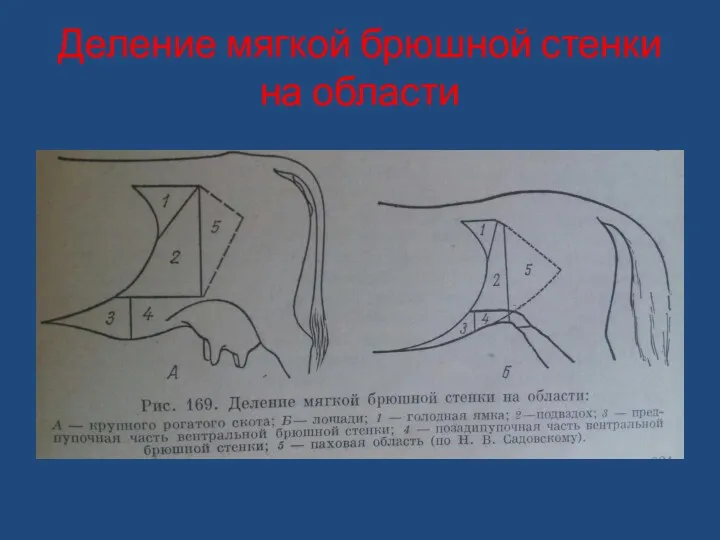 Деление мягкой брюшной стенки на области