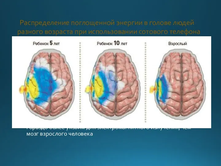 Распределение поглощенной энергии в голове людей разного возраста при использовании