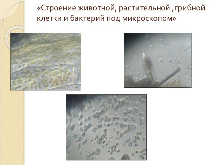 «Строение животной, растительной ,грибной клетки и бактерий под микроскопом»