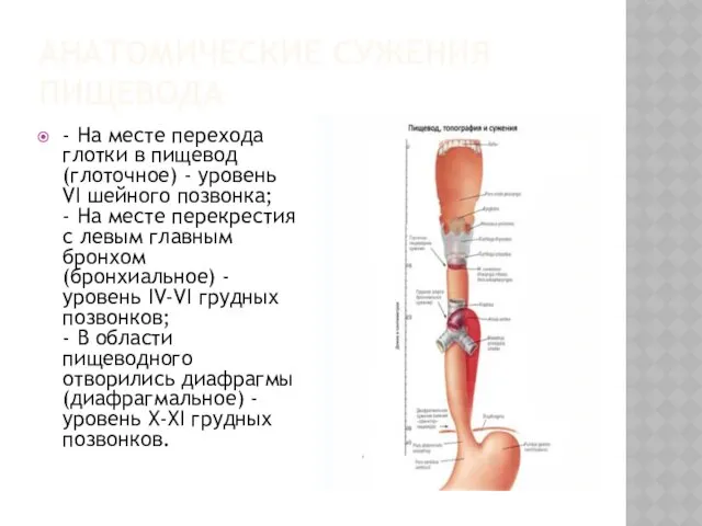 АНАТОМИЧЕСКИЕ СУЖЕНИЯ ПИЩЕВОДА - На месте перехода глотки в пищевод