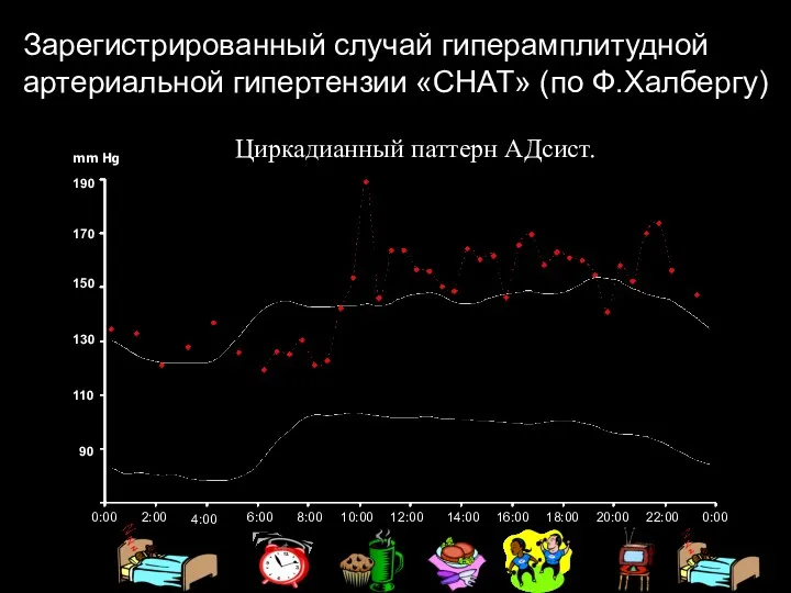 Зарегистрированный случай гиперамплитудной артериальной гипертензии «CHAT» (по Ф.Халбергу) 6:00 0:00