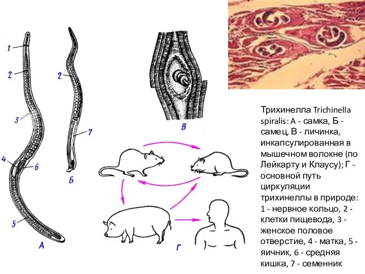 Трихинелла Trichinella spiralis: A - самка, Б - самец, В