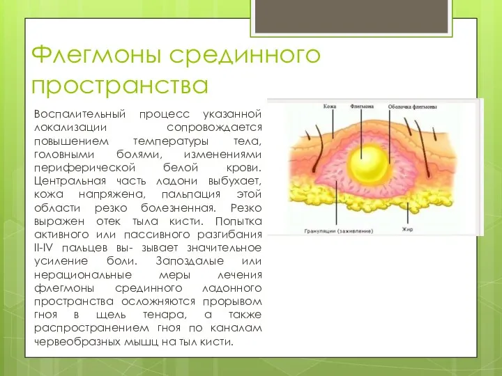 Флегмоны срединного пространства Воспалительный процесс указанной локализации сопровождается повышением температуры