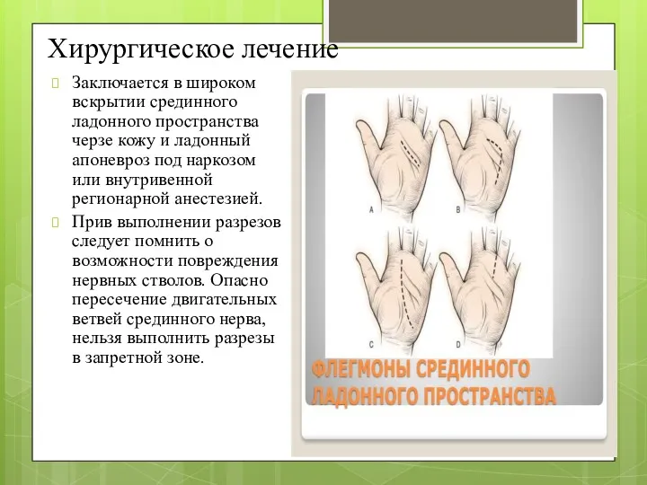 Хирургическое лечение Заключается в широком вскрытии срединного ладонного пространства черзе