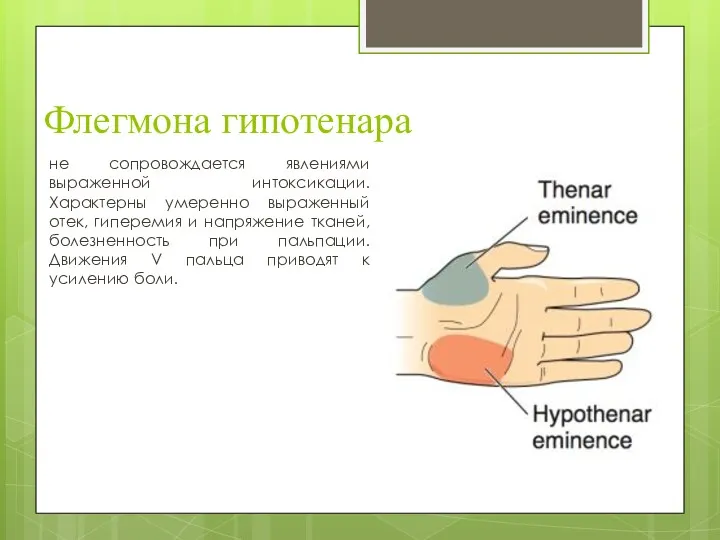 Флегмона гипотенара не сопровождается явлениями выраженной интоксикации. Характерны умеренно выраженный