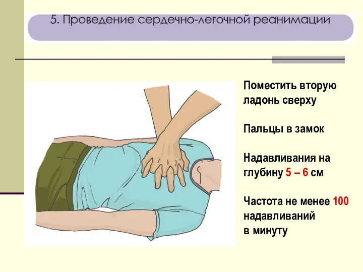 Поместить вторую ладонь сверху Пальцы в замок Надавливания на глубину